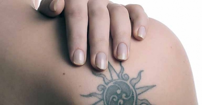 Usuwanie tatuażu
