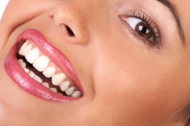 Na wybielanie u stomatologa warto się zdecydować, gdy mamy zęby mocno przebarwione, ułamane lub z defektami szkliwa