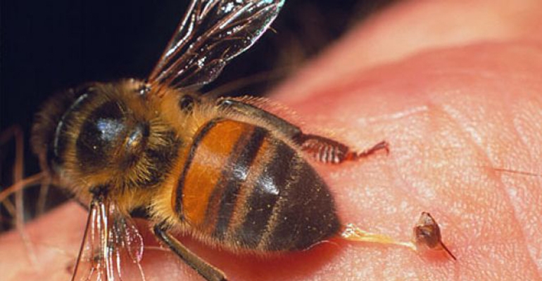 Ukąszenie pszczoły lub osy